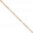 "Love & Kisses" Anklet 14K Yellow Gold